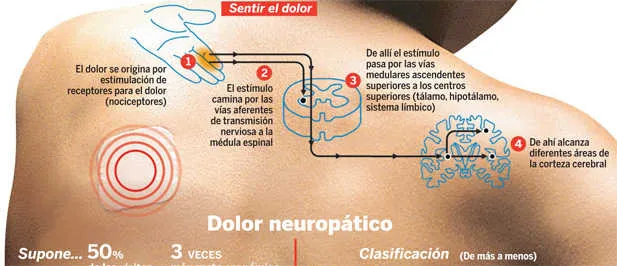 {'en': 'Neuropathic pain by diabetes does not have to incapacitate the patient', 'es': 'El dolor neuropático por diabetes no tiene por qué incapacitar al paciente'} Image