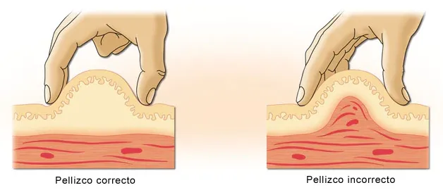 {'en': '"Bulk" at the injection place', 'es': '"Bulto" en el lugar de la inyección'} Image