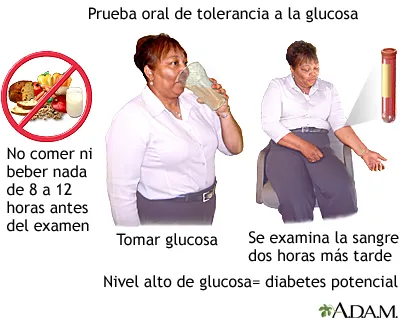 {'en': 'Type 2 diabetes', 'es': 'Diabetes tipo 2'} Image