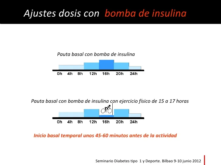 {'en': 'Temporary basal and sport', 'es': 'Basal temporal y Deporte'} Image