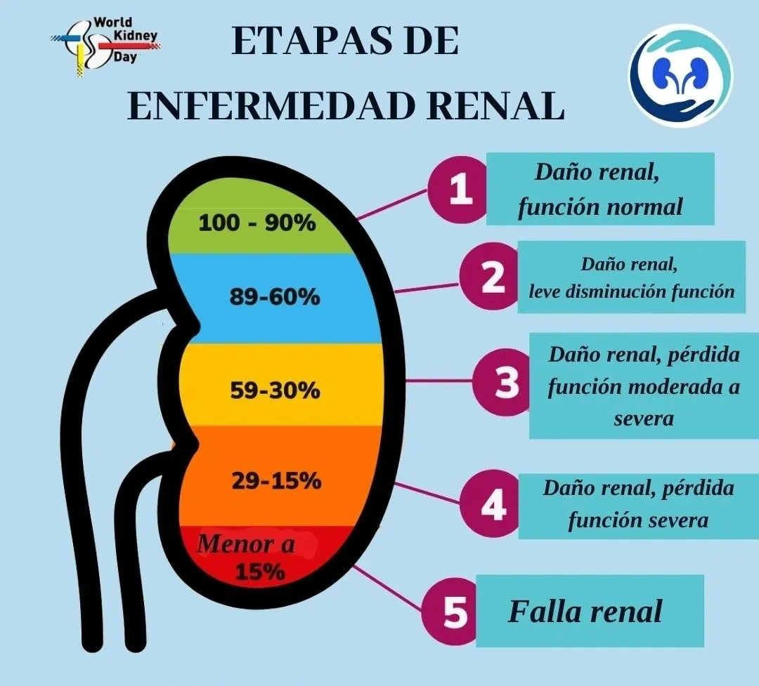 {'en': 'How does chronic kidney disease (ERC) affect people with type 2 diabetes?', 'es': '¿Cómo afecta la enfermedad renal crónica (ERC) a las personas con diabetes tipo 2?'} Image