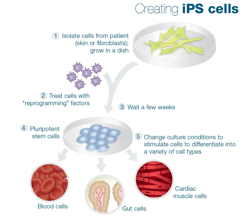 {'en': 'Cell transplant with new IPS technique, possible cure for type 1 diabetes?', 'es': 'Trasplante de células con nueva técnica IPS ¿Posible cura para la diabetes tipo 1?'} Image