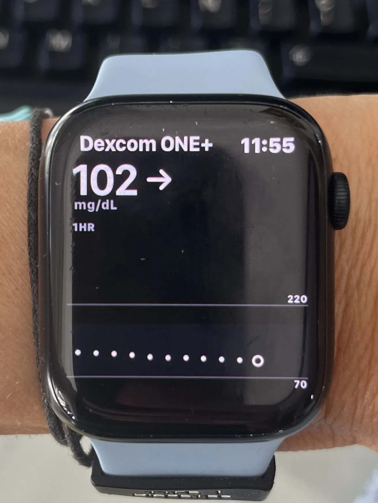 {'en': 'Help with Dexcom One + at Apple Watch', 'es': 'Ayuda con Dexcom one + en el apple watch'} Image