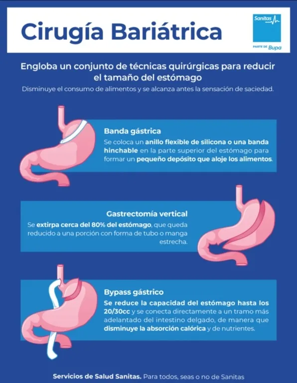 {'en': 'Bariatric surgery: a light of hope for the control of type 2 diabetes', 'es': 'Cirugía Bariátrica: Una Luz de Esperanza para el Control de la Diabetes Tipo 2'} Image