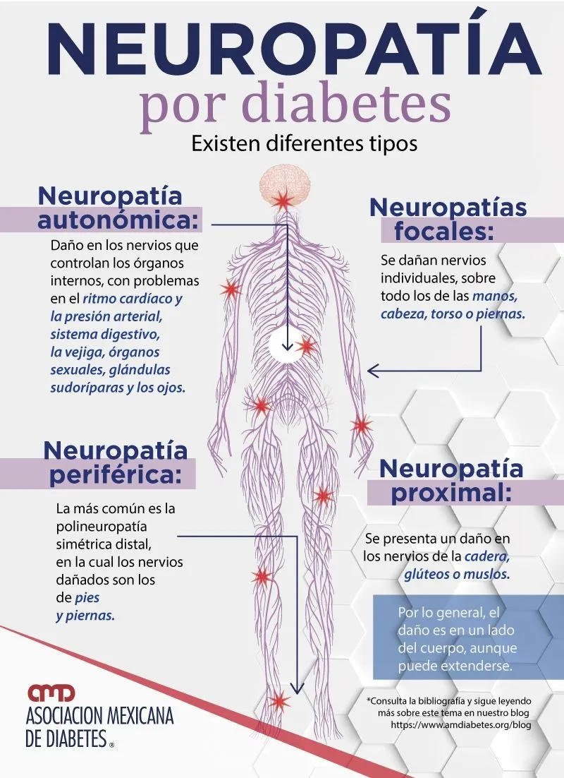 {'en': 'Taking vitamin B can prevent peripheral neuropathy caused by diabetes', 'es': 'Tomar vitamina B puede prevenir la neuropatía periférica causada por la diabetes'} Image