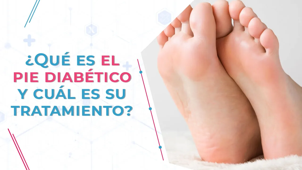 {'en': 'Diabetic foot', 'es': 'Pie diabetico'} Image