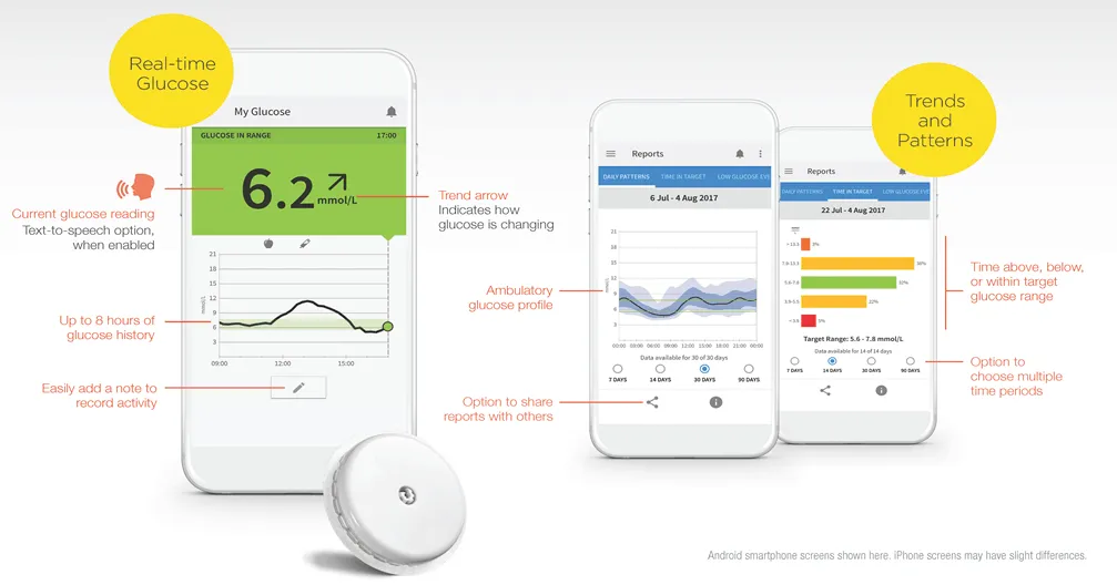 {'en': 'How long does a sensor last without activating?', 'es': '¿Cuánto dura un sensor puesto sin activar?'} Image