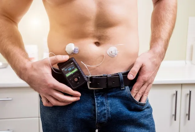 {'en': 'Insulin pumps', 'es': 'Bombas de insulina'} Image