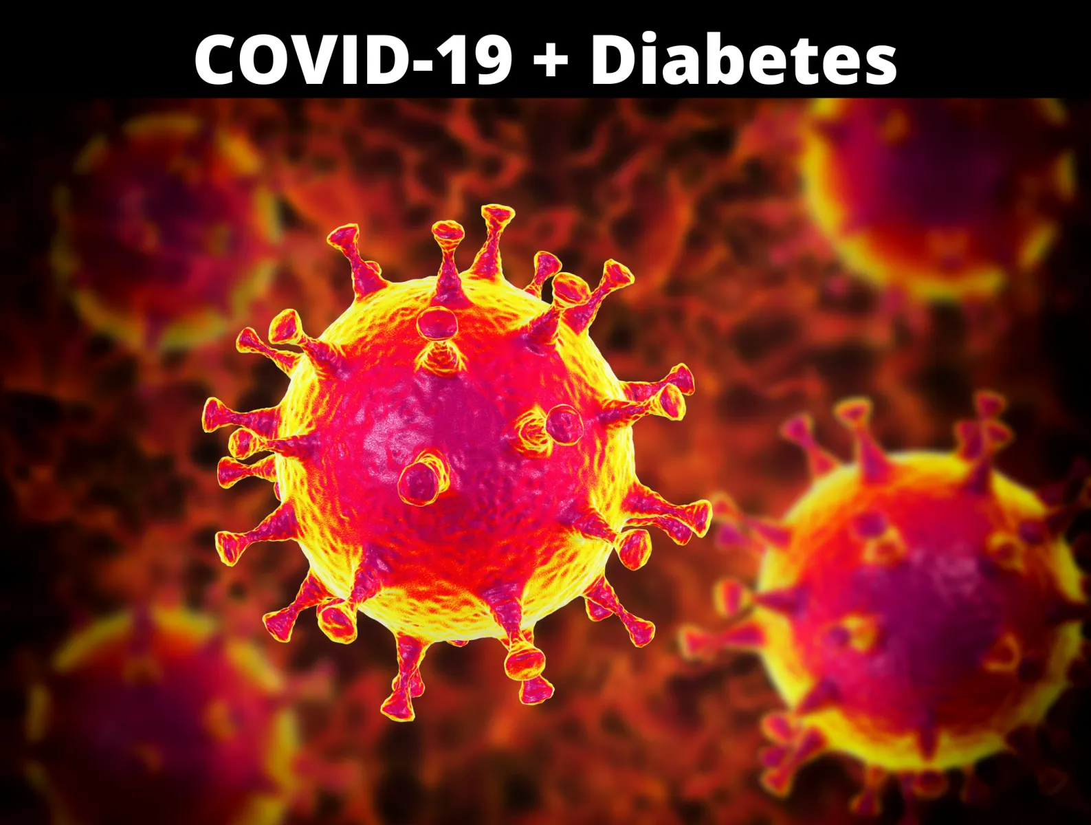 {'en': 'Diabetes 1 and Coronavirus should we worry?', 'es': 'Diabetes 1 y Coronavirus ¿Deberíamos preocuparnos?'} Image