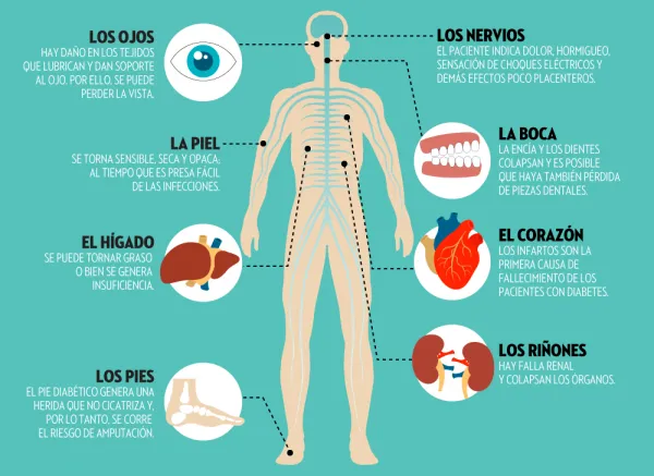 {'en': 'In the short and long term, what consequences can you have to suffer diabetes?', 'es': 'A corto y a largo plazo, ¿qué consecuencias puede tener padecer la diabetes?'} Image