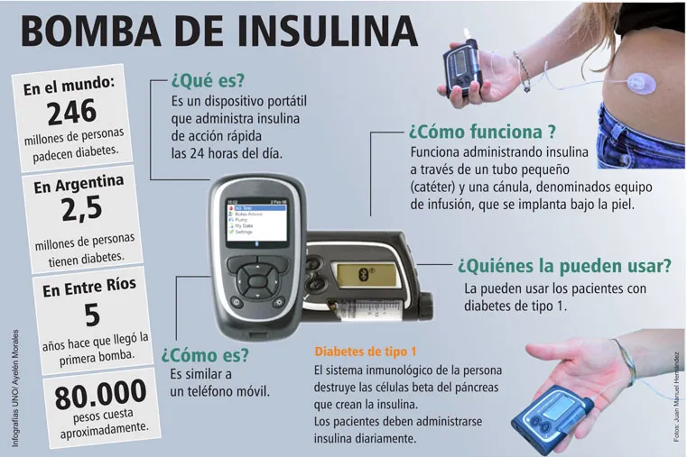 {'en': 'Insulin pump, criteria to recommend its use.', 'es': 'Bomba de insulina, criterios para recomendar su uso.'} Image