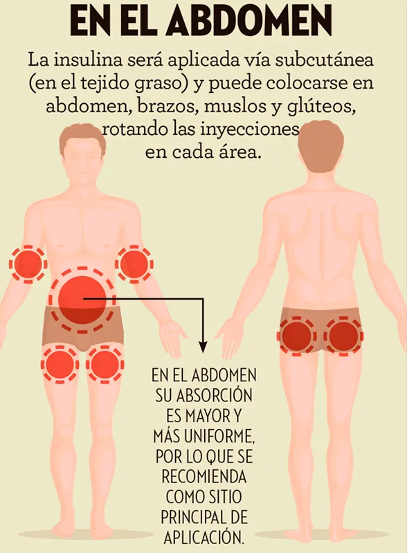 {'en': 'Thanks in advance ... adolescent father with recent diabetes.', 'es': 'Gracias de antemano... Padre de adolescente con diabetes reciente.'} Image