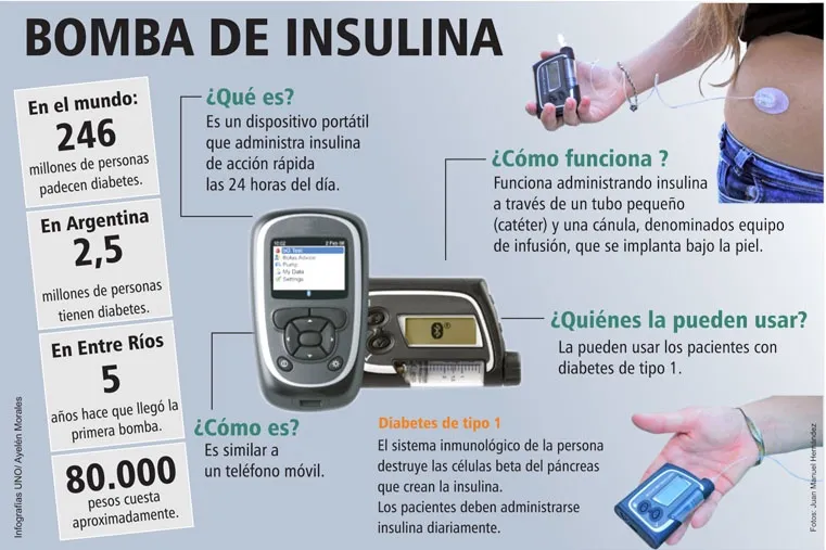 {'en': 'They seek to provide free insulin bombs to diabetic students', 'es': 'Buscan proveer bombas de insulina gratis a estudiantes diabéticos'} Image