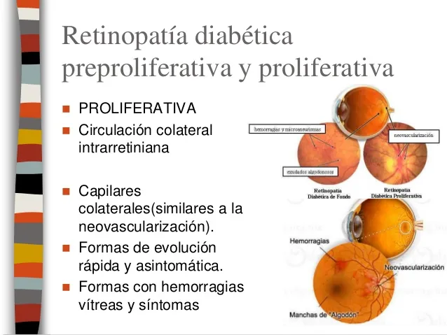 {'en': 'How does retinopathy progress?', 'es': '¿Cómo avanza la retinopatía?'} Image