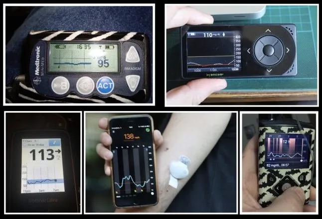 {'en': 'Continuous, comparative meters.(Dexcom vs Freestyle Libre vs Guardian)', 'es': 'Medidores continuos, Comparativa. (Dexcom vs FreeStyle Libre vs Guardian)'} Image