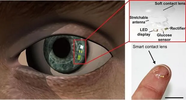 {'en': 'They design a ‘intelligent’ lenses to monitor glucose levels in diabetes', 'es': 'Diseñan una lentilla ‘inteligente’ para monitorizar los niveles de glucosa en la diabetes'} Image