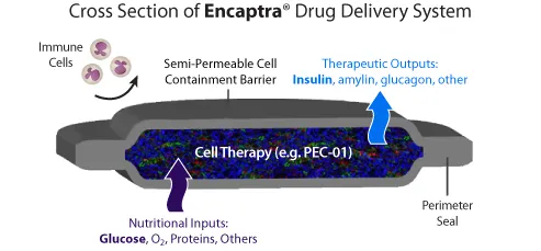 {'en': 'Johnson & Johnson, Viacyte prove possible type 1 diabetes cure', 'es': 'Johnson & Johnson, ViaCyte prueban posible cura de diabetes Tipo 1'} Image