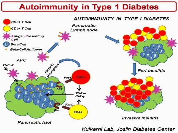 {'en': 'TCD4 cell, involved in type 1 diabetes', 'es': 'Célula TCD4, implicada en la diabetes tipo 1'} Image