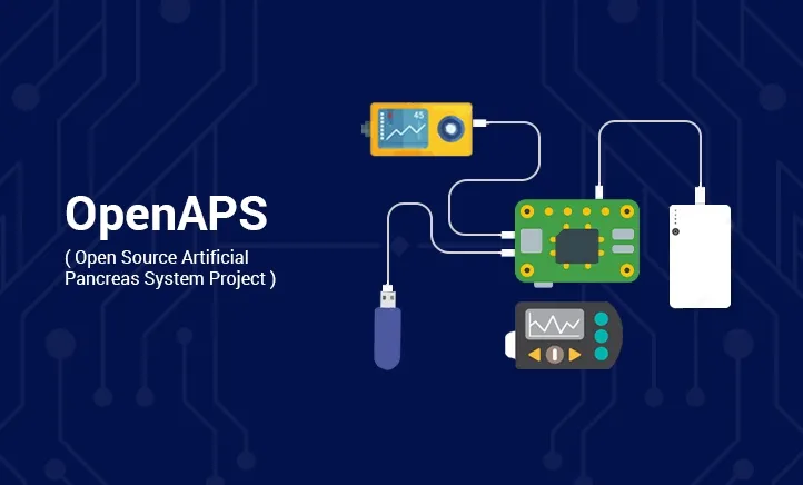 {'en': '"Home" artificial pancreas (Openops)', 'es': 'Páncreas artificial "casero" (OpenAPS)'} Image