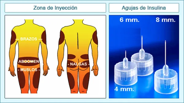 {'en': 'Bolis needles, what measure do you like more and why?', 'es': 'Agujas para bolis, que medida os gusta mas y porque?'} Image