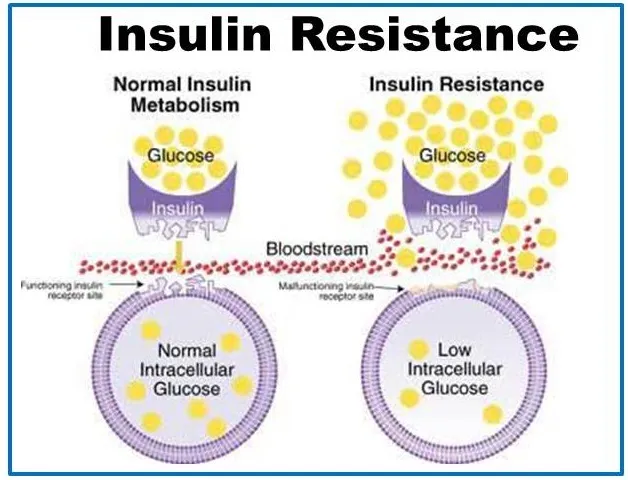 {'en': 'Discovered new insulin resistance mechanism in type 2 diabetes', 'es': 'Descubierto nuevo mecanismo de resistencia a la insulina en la diabetes tipo 2'} Image