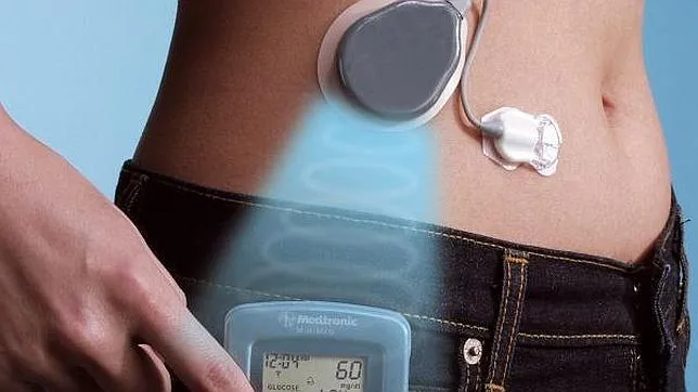 {'en': 'Insulin pumps reduce cardiovascular risk by 50%', 'es': 'Las bombas de insulina reducen un 50% el riesgo cardiovascular'} Image